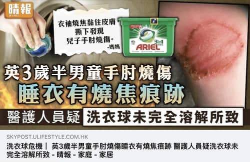 機洗新寵洗衣球🍬 使用不當恐灼傷皮膚